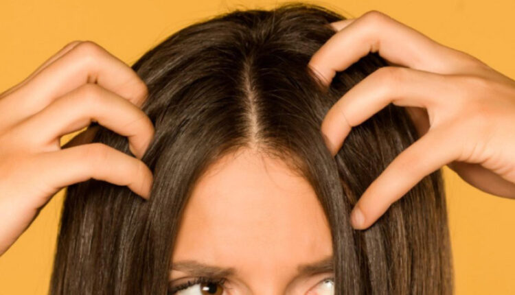 درمان پوسته سر در خانه