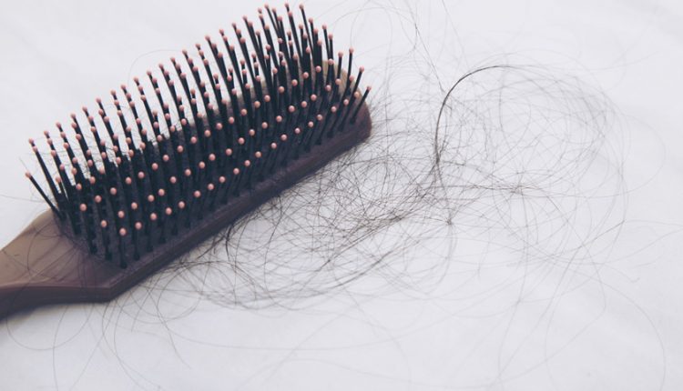 ویتامین برای ریزش مو