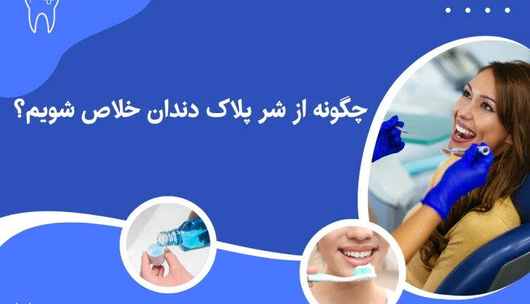 از بین بردن پلاک دندان