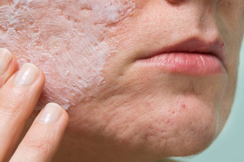 علت خشکی پوست