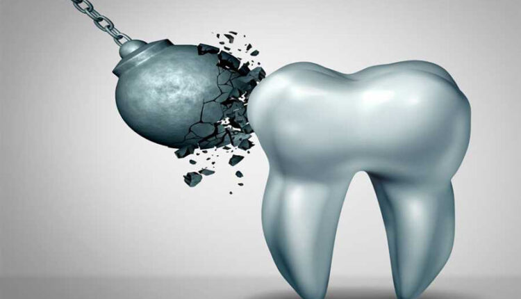 فرسایش مینای دندان