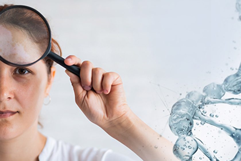 علت خشکی پوست