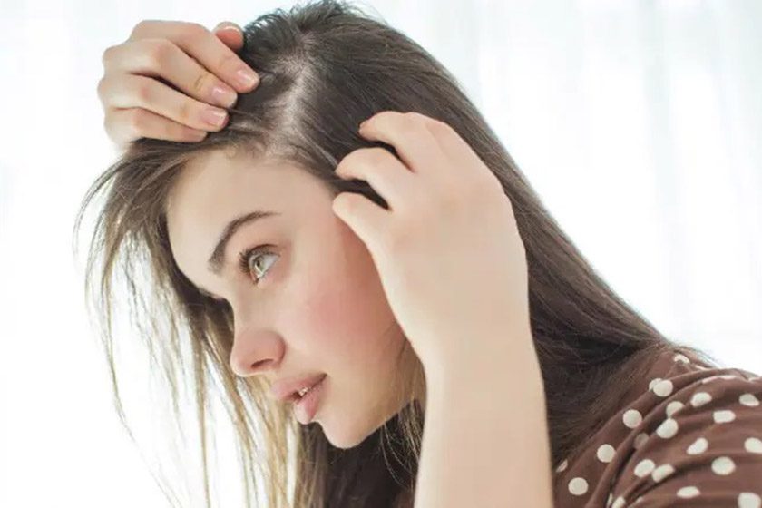 نازک شدن موها