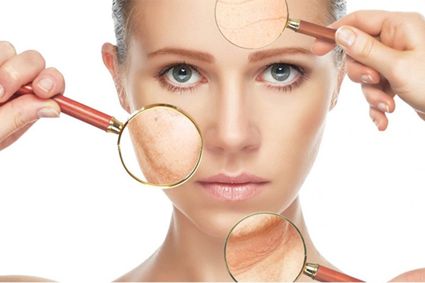 لوسیون صورت چیست؟