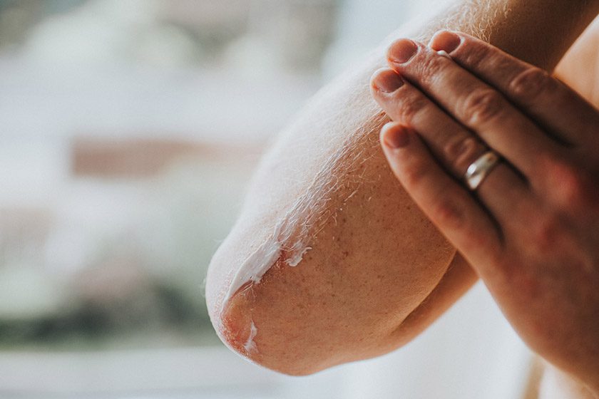 انواع خشکی پوست