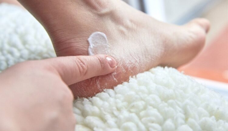 درمان خشکی پوست پا