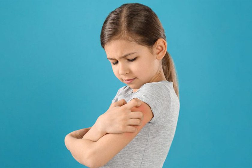 دلیل بیماری اگزما