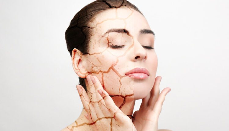 درمان پوست کم آب