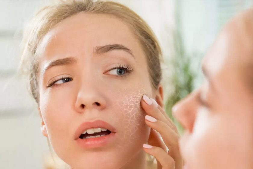 درمان پوست کم آب