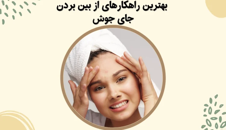 از بین بردن جای جوش