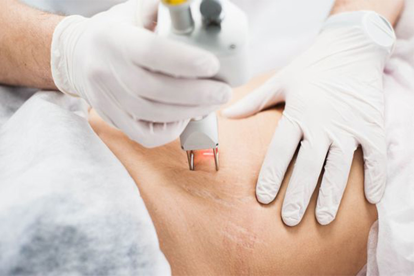 تاثیر لوسیون بدن در درمان ترک‌های پوستی