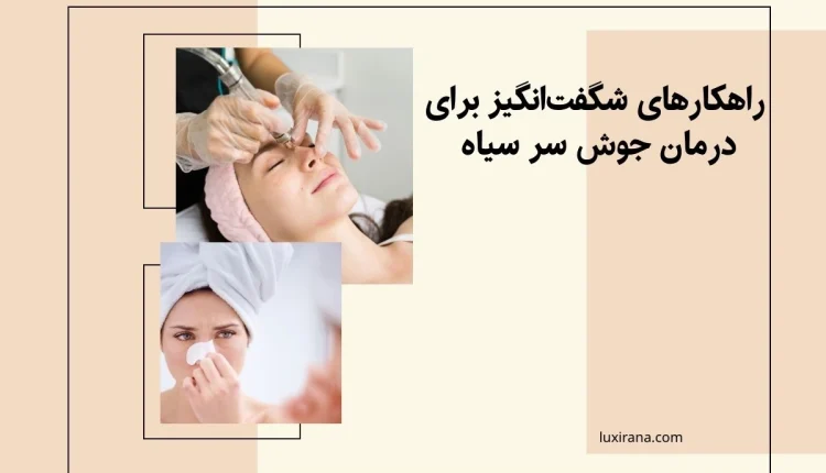 درمان جوش سر سیاه