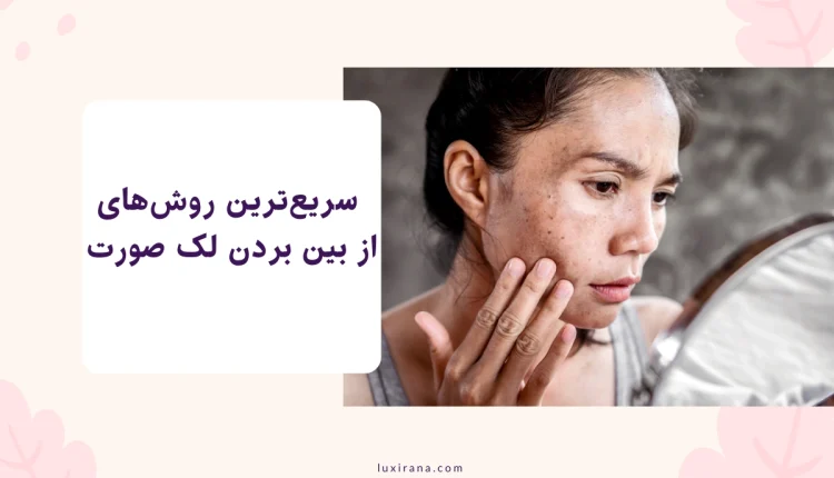 از بین بردن لک صورت