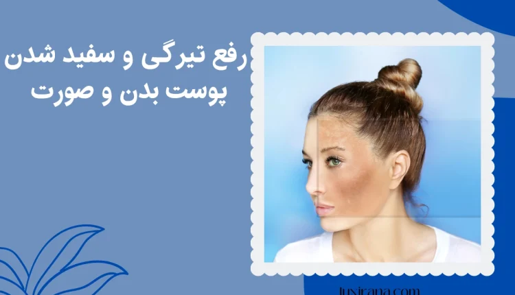 رفع تیرگی پوست