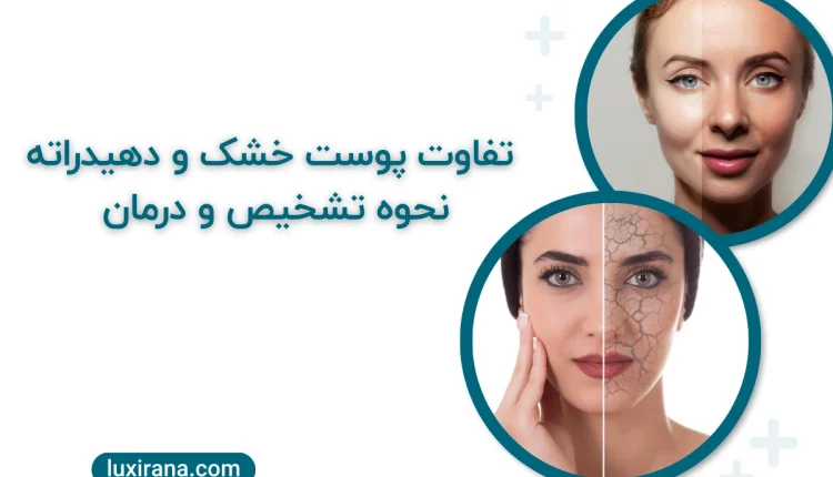 تفاوت پوست خشک و دهیدراته