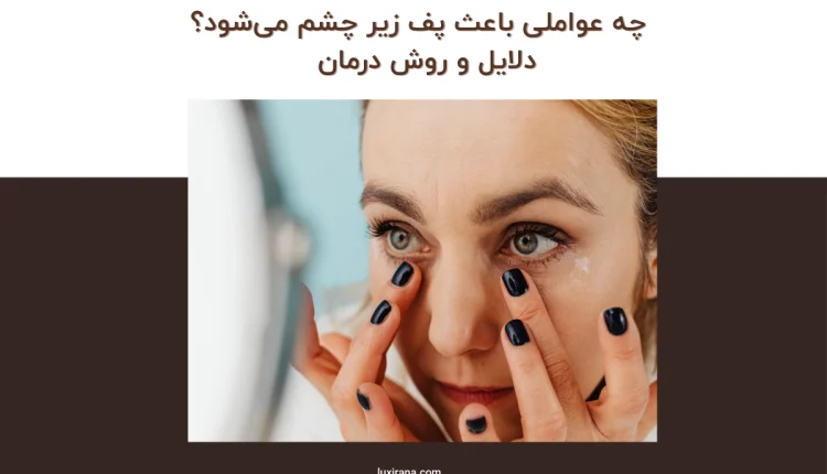 چه عواملی باعث پف زیر چشم میشود
