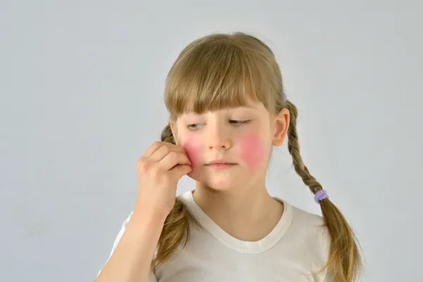 درمان و پیشگیری از قرمزی و التهاب پوست