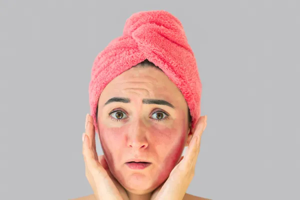 آیا مراجعه به پزشک ضروری است؟