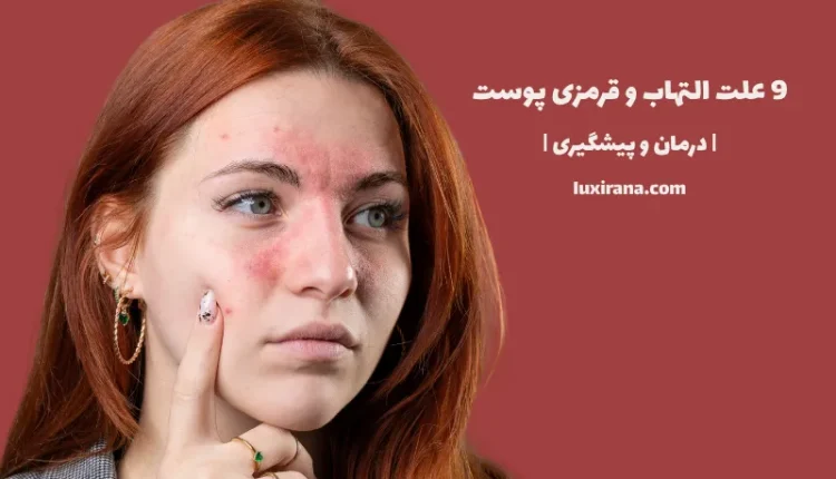 9 علت التهاب و قرمزی پوست