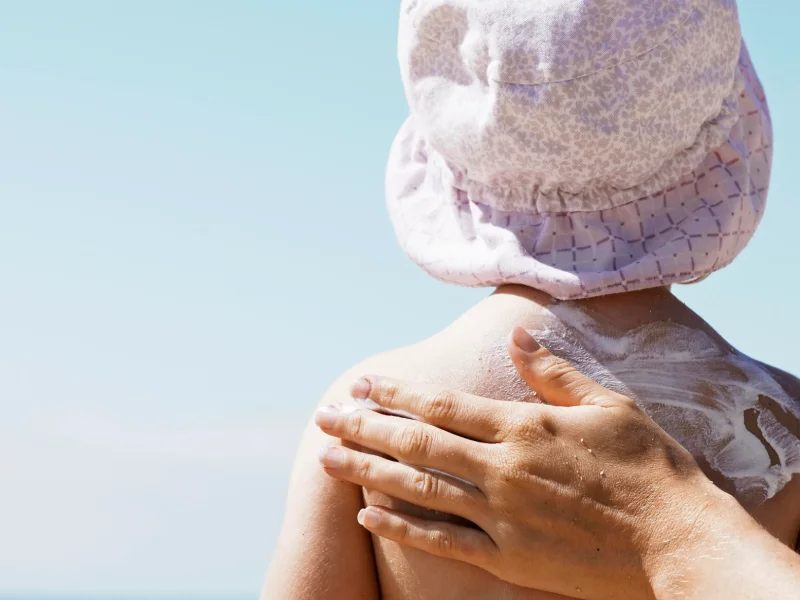 بهترین کرم آفتاب سوختگی کودکان کدام است؟