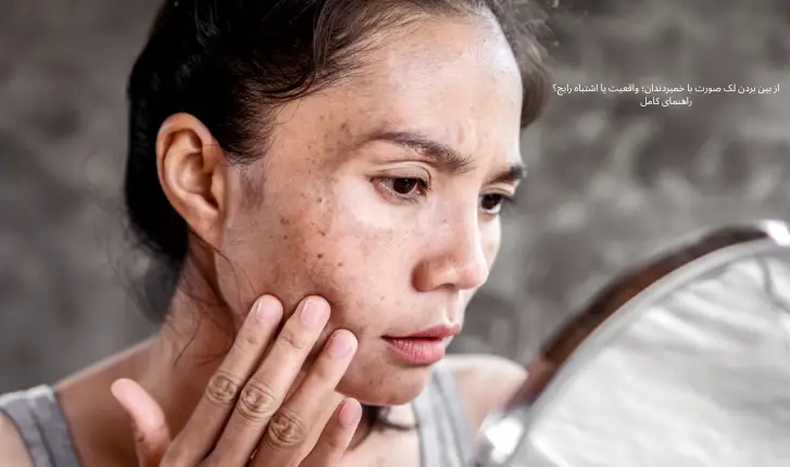 از بین بردن لک صورت با خمیردندان؛ واقعیت یا اشتباه رایج؟ راهنمای کامل|مجله لوکسیرانا