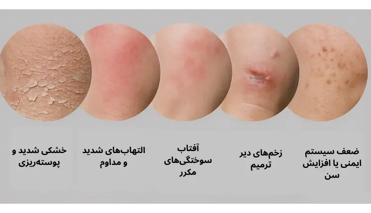 تصویر انواع لکه‌های پوستی | مجله لوکسیرانا