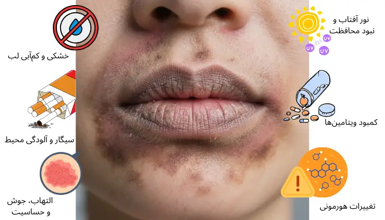 علت تیرگی چانه و دور لب | مجله لوکسیرانا