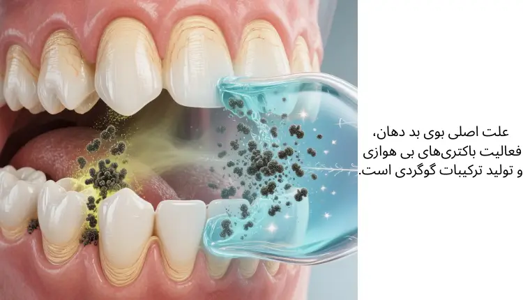 علت بوی بد دهان و بهترین دهانشویه برای بوی بد دهان | مجله لوکسیرانا