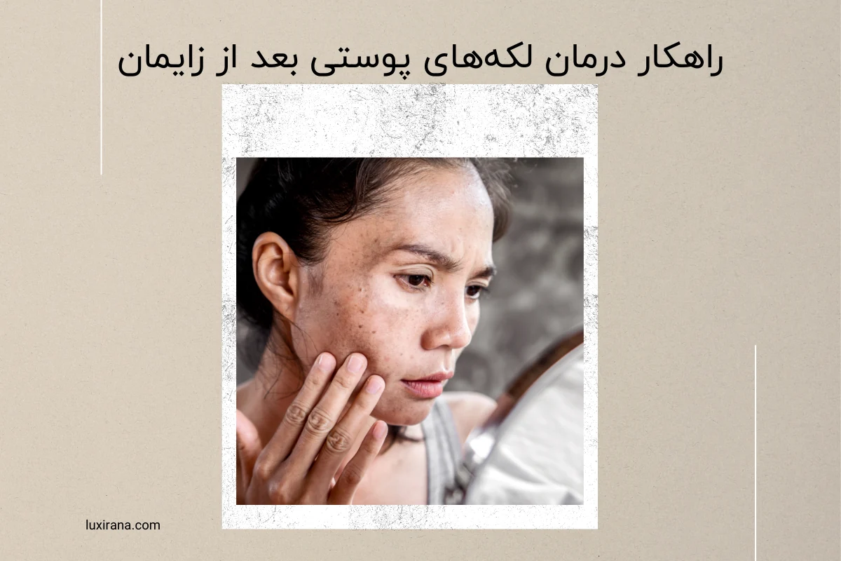 درمان لکه‌های پوستی بعد از زایمان