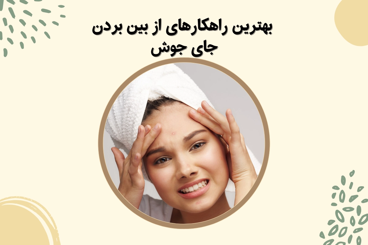 از بین بردن جای جوش