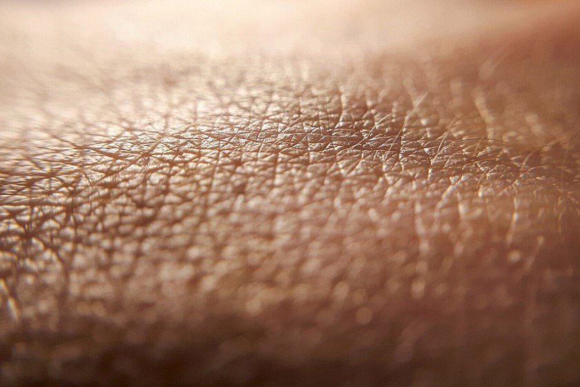 جلوگیری از ترک‌های پوستی
