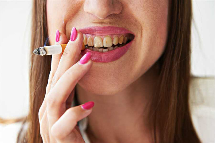 تأثیر مسواک زدن در پیشگیری از تشکیل پلاک و تارتار