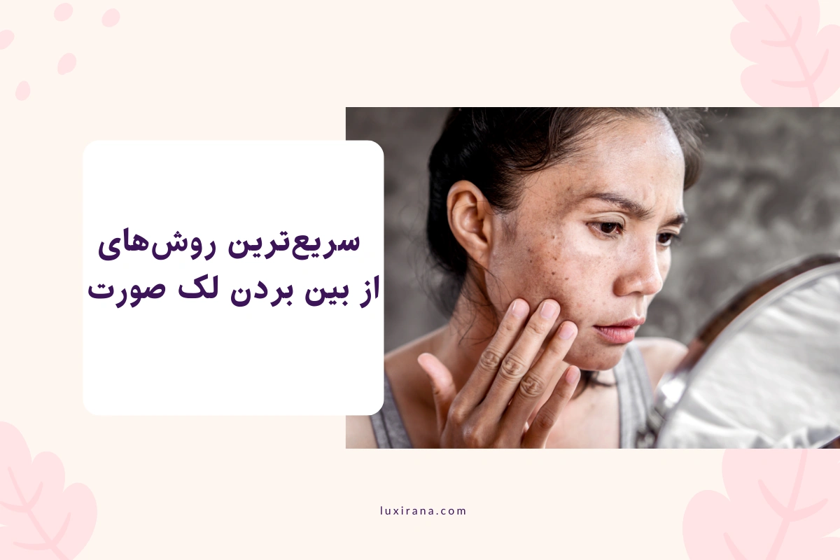 از بین بردن لک صورت