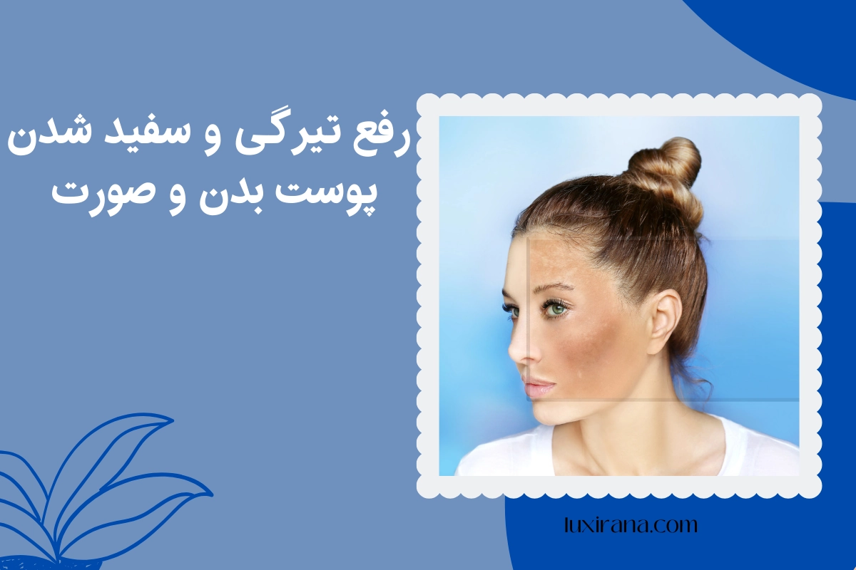رفع تیرگی پوست