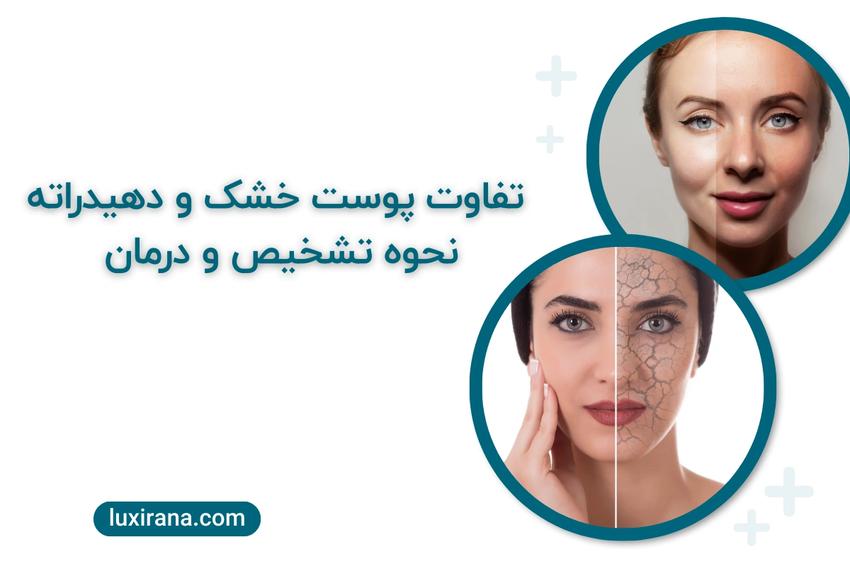 تفاوت پوست خشک و دهیدراته