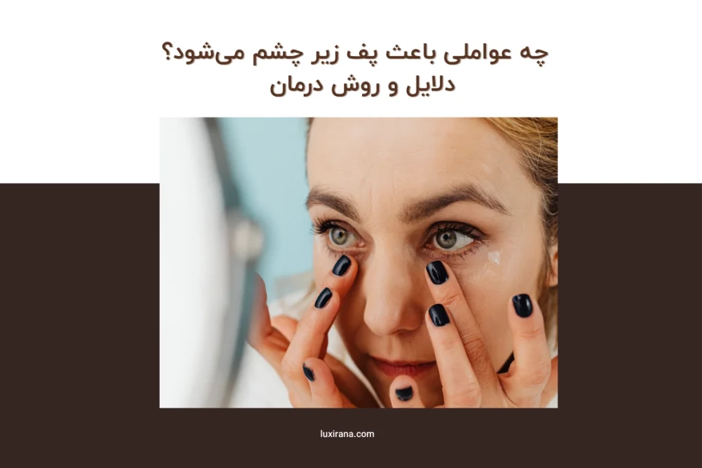 چه عواملی باعث پف زیر چشم میشود