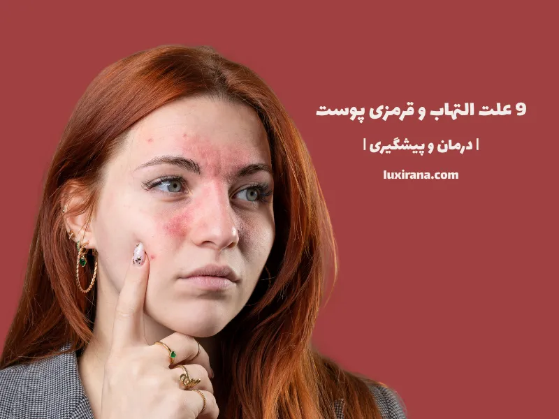 9 علت التهاب و قرمزی پوست