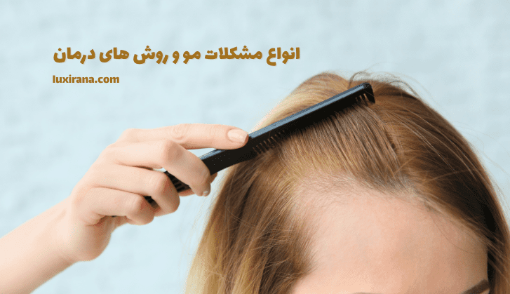 انواع مشکلات مو و روش های درمان