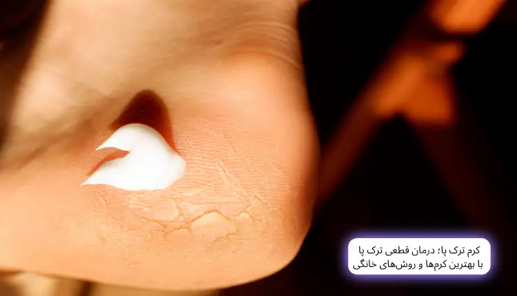 کرم ترک پا؛ درمان قطعی ترک پا با بهترین کرم‌ها و روش‌های خانگی | مجله لوکسیرانا