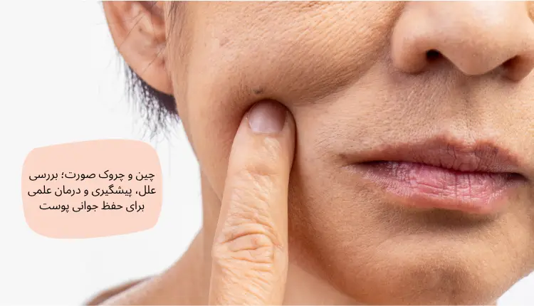 چین و چروک صورت؛ بررسی علل، پیشگیری و درمان علمی برای حفظ جوانی پوست | مجله لوکسیرانا