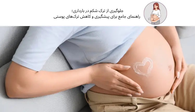 جلوگیری از ترک شکم در بارداری؛ راهنمای جامع برای پیشگیری و کاهش ترک‌های پوستی | مجله لوکسیرانا