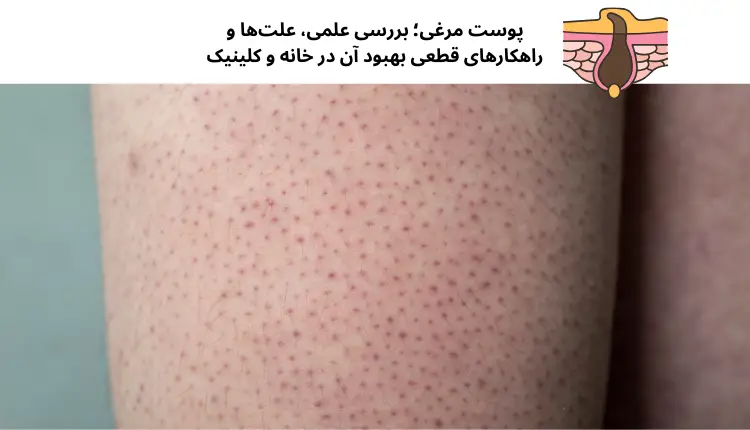 پوست مرغی؛ بررسی علمی، علت‌ها و راهکارهای قطعی بهبود آن در خانه و کلینیک | مجله لوکسیرانا