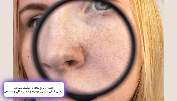 منافذ باز پوست (علت، درمان قطعی و روش‌های بستن منافذ باز صورت در خانه) |مجله لوکسیرانا